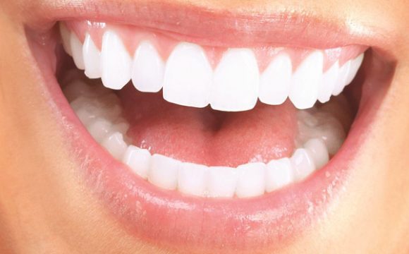 Zirkonyum Veneers