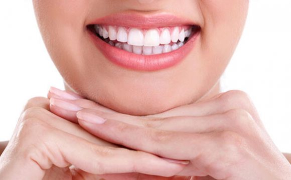 Estetik Gülüş Tasarımı